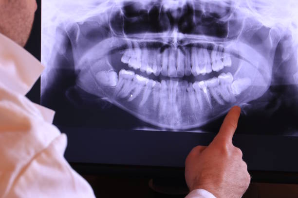 Best Emergency Dental Care for Broken or Chipped Teeth in , AZ